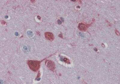 Immunohistochemistry-Paraffin: RAE1 Antibody [NB100-1894]