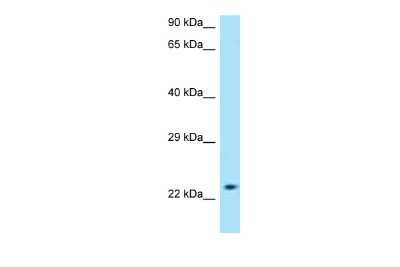 Western Blot: RAG1AP1 Antibody [NBP2-85590]