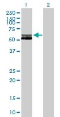 Western Blot: RAG2 Antibody [H00005897-B01P]
