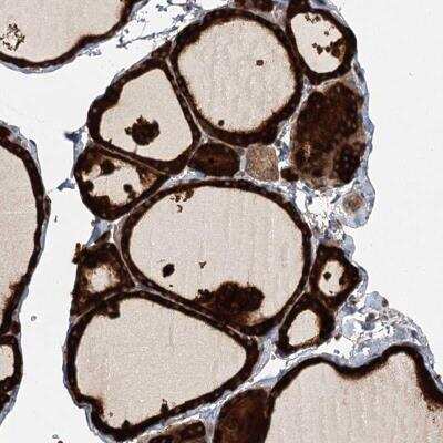 Immunohistochemistry: RAGEF2 Antibody [NBP2-46660]