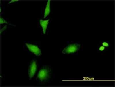 Immunocytochemistry/ Immunofluorescence: RAIDD/CRADD Antibody (1F8) [H00008738-M01]