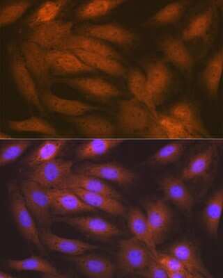 Immunocytochemistry/ Immunofluorescence: RAIDD/CRADD Antibody (3Z9N8) [NBP3-16672]