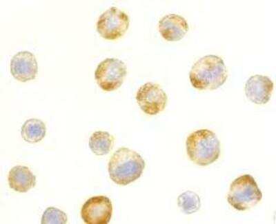 Immunocytochemistry/ Immunofluorescence: RAIDD/CRADD Antibody - BSA Free [NBP1-77061]
