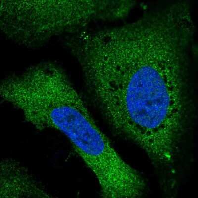 Immunocytochemistry/ Immunofluorescence: RALBP1 Antibody [NBP2-30698]