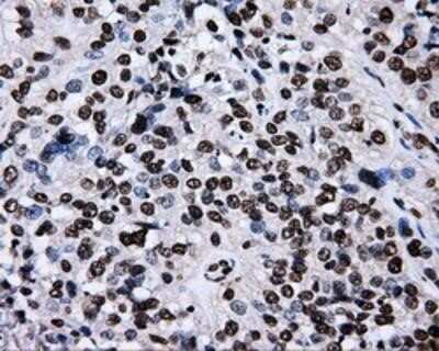 Immunohistochemistry-Paraffin: RALBP1 Antibody (OTI11B2) [NBP2-02293]