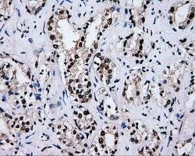 Immunohistochemistry-Paraffin: RALBP1 Antibody (OTI11B2) [NBP2-02293]
