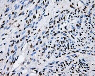 Immunohistochemistry-Paraffin: RALBP1 Antibody (OTI11B2) [NBP2-02293]