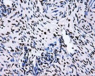 Immunohistochemistry-Paraffin: RALBP1 Antibody (OTI11B2) [NBP2-02293]
