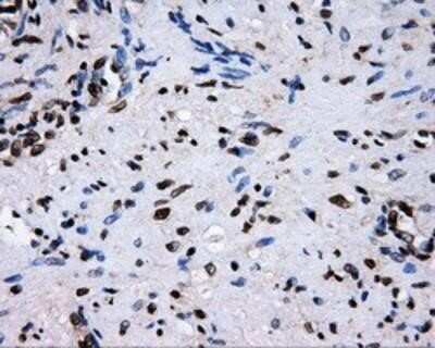 Immunohistochemistry-Paraffin: RALBP1 Antibody (OTI11B2) [NBP2-02293]