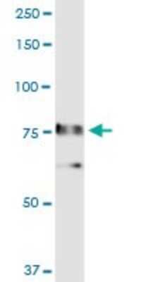 Western Blot: RALBP1 Antibody [H00010928-D01P]