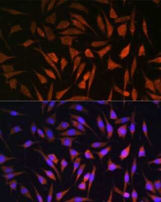 Immunocytochemistry/ Immunofluorescence: RALGDS Antibody - Azide and BSA Free [NBP2-93790]