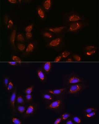 Immunocytochemistry/ Immunofluorescence: RALGDS Antibody - Azide and BSA Free [NBP2-93790]
