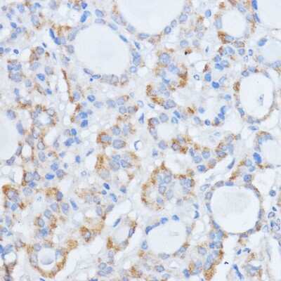 Immunohistochemistry-Paraffin: RALGDS Antibody - Azide and BSA Free [NBP2-93790]