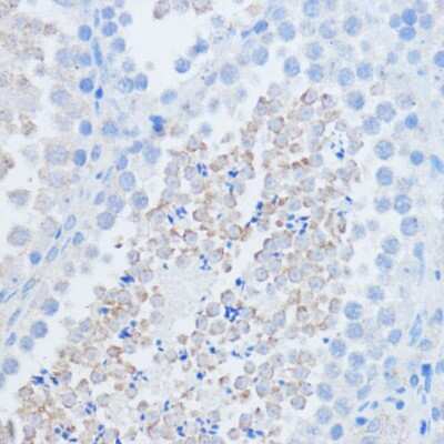 Immunohistochemistry-Paraffin: RALGDS Antibody - Azide and BSA Free [NBP2-93790]
