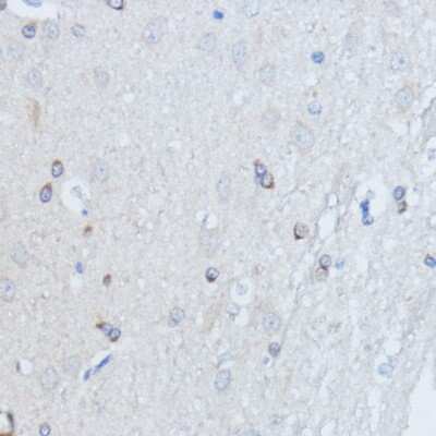 Immunohistochemistry-Paraffin: RALGDS Antibody - Azide and BSA Free [NBP2-93790]