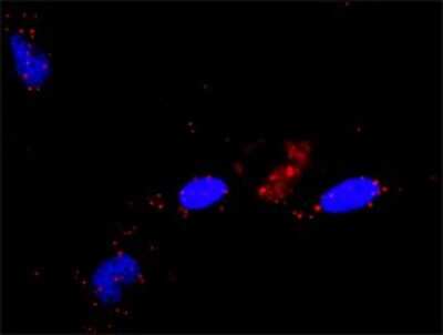 Proximity Ligation Assay: RALGDS Antibody [H00005900-D01P]