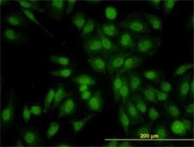 Immunocytochemistry/ Immunofluorescence: RALGPS2 Antibody (3F1) [H00055103-M01]