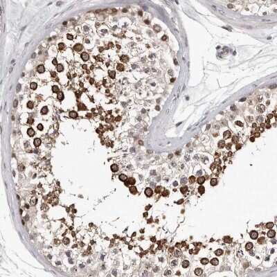 Immunohistochemistry-Paraffin: RALGPS2 Antibody [NBP1-84645]