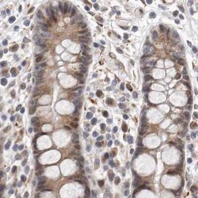 Immunohistochemistry-Paraffin: RALGPS2 Antibody [NBP1-84645]
