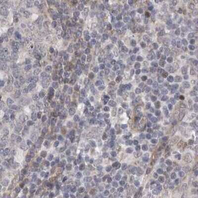 Immunohistochemistry-Paraffin: RALGPS2 Antibody [NBP1-84645]