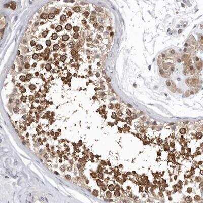 Immunohistochemistry-Paraffin: RALGPS2 Antibody [NBP1-84646]
