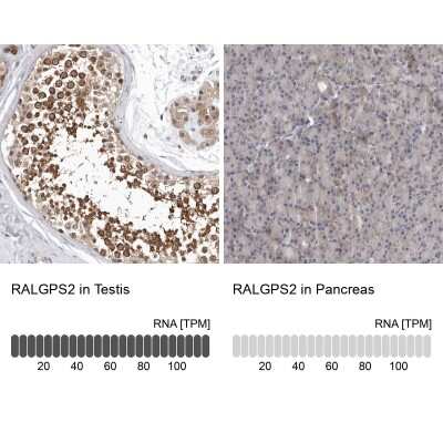 Immunohistochemistry-Paraffin: RALGPS2 Antibody [NBP1-84646]