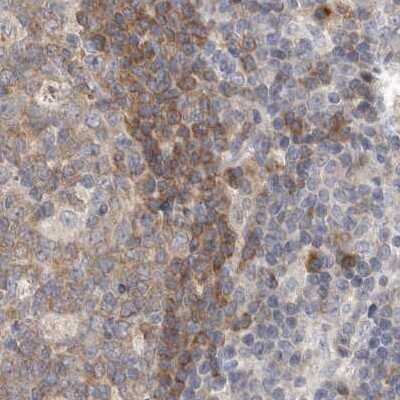 Immunohistochemistry-Paraffin: RALGPS2 Antibody [NBP1-84646]
