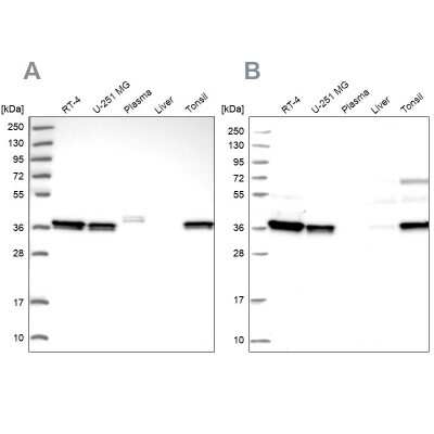 Western Blot: RALY Antibody [NBP2-13201]