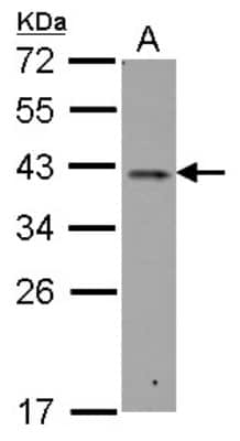 Western Blot: RALY Antibody [NBP2-20065]