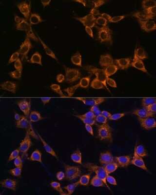 Immunocytochemistry/ Immunofluorescence: RAMP1 Antibody - BSA Free [NBP2-94078]