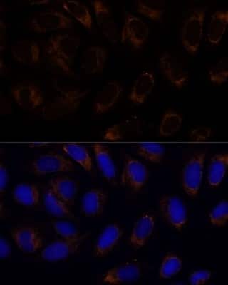 Immunocytochemistry/ Immunofluorescence: RAMP1 Antibody - BSA Free [NBP2-94078]