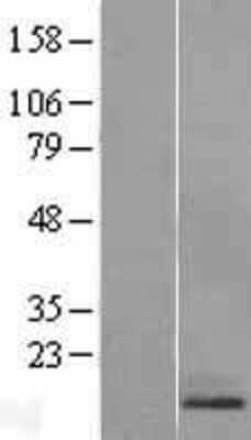 Western Blot: RAMP1 Overexpression Lysate [NBL1-15136]