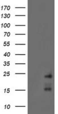 Western Blot: RAMP2 Antibody (OTI4E5) [NBP2-01853]