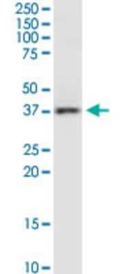 Western Blot: RAMP3 Antibody (1C11) [H00010268-M01]