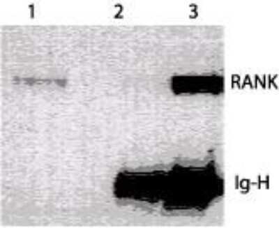 Western Blot: RANK/TNFRSF11A Antibody (64C1385.1)Azide Free [NBP2-33256]