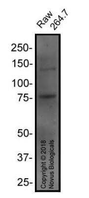 Western Blot: RANK/TNFRSF11A Antibody (64C1385.1)Azide Free [NBP2-33256]