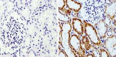 Immunohistochemistry: RAP1A Antibody (1D2-1C64) [NBP2-22526]