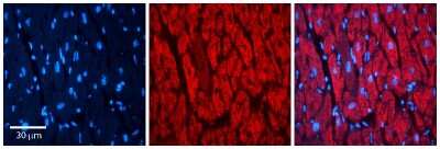 Immunohistochemistry: RAP1B Antibody [NBP1-54871]