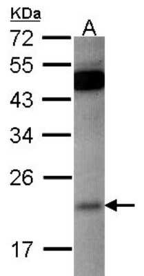 Western Blot: RAP1B Antibody [NBP2-20072]