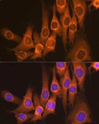 Immunocytochemistry/ Immunofluorescence: RAP1GAP Antibody (8V9I6) [NBP3-16234]