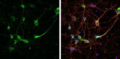 Immunocytochemistry/ Immunofluorescence: RAP1GAP Antibody [NBP3-13216]