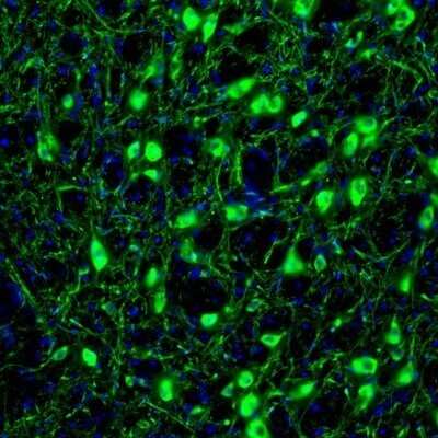 Immunohistochemistry: RAP1GAP Antibody [NBP1-83002]