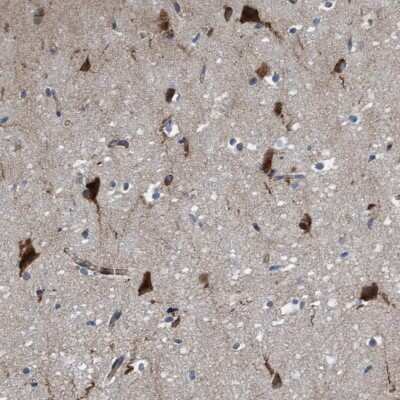 Immunohistochemistry-Paraffin: RAP1GAP2 Antibody [NBP1-93721]