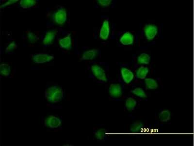 Immunocytochemistry/ Immunofluorescence: RAP1GDS1 Antibody [H00005910-B01P]