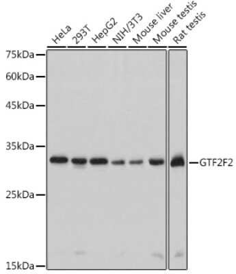 Western Blot: RAP30 Antibody (3T7Q9) [NBP3-15275]
