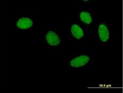 Immunocytochemistry/ Immunofluorescence: RAP74 Antibody [H00002962-B01P]