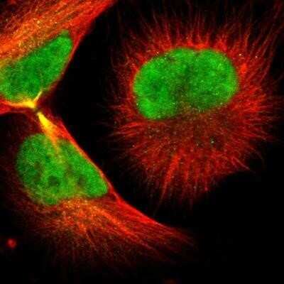 Immunocytochemistry/ Immunofluorescence: RAP30 Antibody [NBP3-17973]