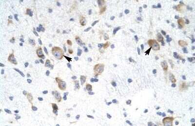 Immunohistochemistry-Paraffin: RAP30 Antibody [NBP3-17979]