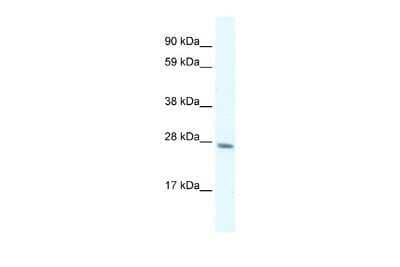 Western Blot: RAP30 Antibody [NBP3-17978]
