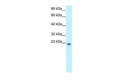 Western Blot: RAP30 Antibody [NBP3-17979]